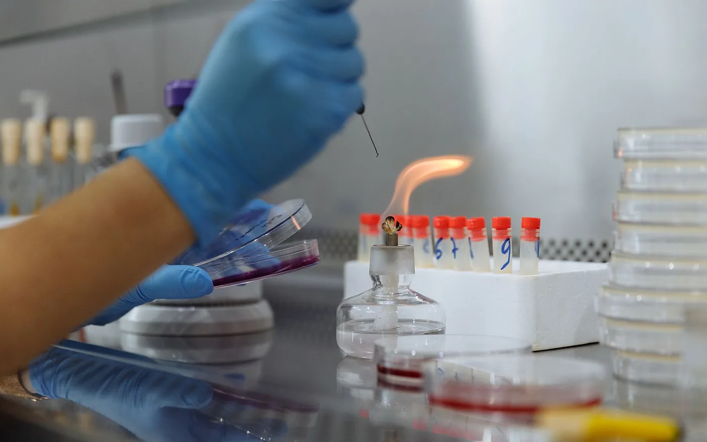Bacterial colonies in a petri dish next to food samples in a laboratory - abnormal food test result, Kesar Digum